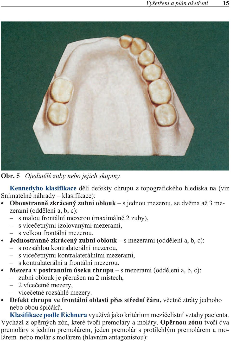 se dvìma až 3 mezerami (oddìlení a, b, c): s malou frontální mezerou (maximálnì 2 zuby), s víceèetnými izolovanými mezerami, s velkou frontální mezerou.