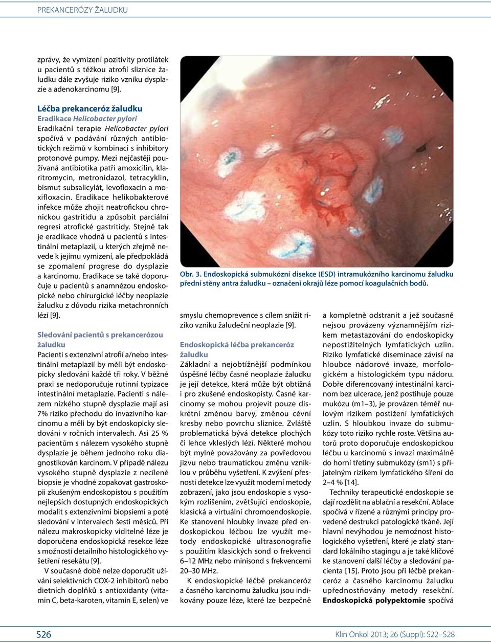 Mezi nejčastěji používaná antibio tika patří amoxicilin, klaritromycin, metronidazol, tetracyklin, bismut subsalicylát, levofloxacin a moxifloxacin.