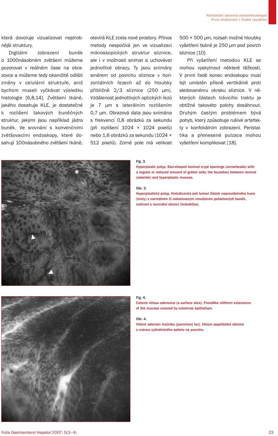 histologie [6,8,14]. Zvětšení tkáně, jakého dosahuje KLE, je dostatečné k rozlišení takových buněčných struktur, jakými jsou například jádra buněk.