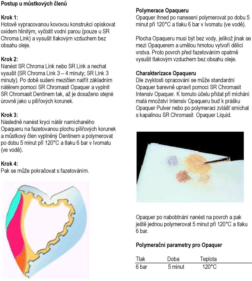 Po době sušení mezičlen natřít základním nátěrem pomocí SR Chromasit Opaquer a vyplnit SR Chromasit Dentinem tak, až je dosaženo stejné úrovně jako u pilířových korunek.