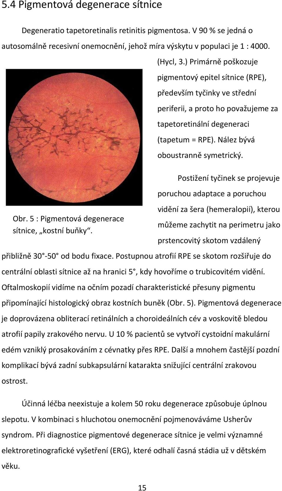 Postižení tyčinek se projevuje poruchou adaptace a poruchou vidění za šera (hemeralopií), kterou můžeme zachytit na perimetru jako prstencovitý skotom vzdálený přibližně 30-50 od bodu fixace.