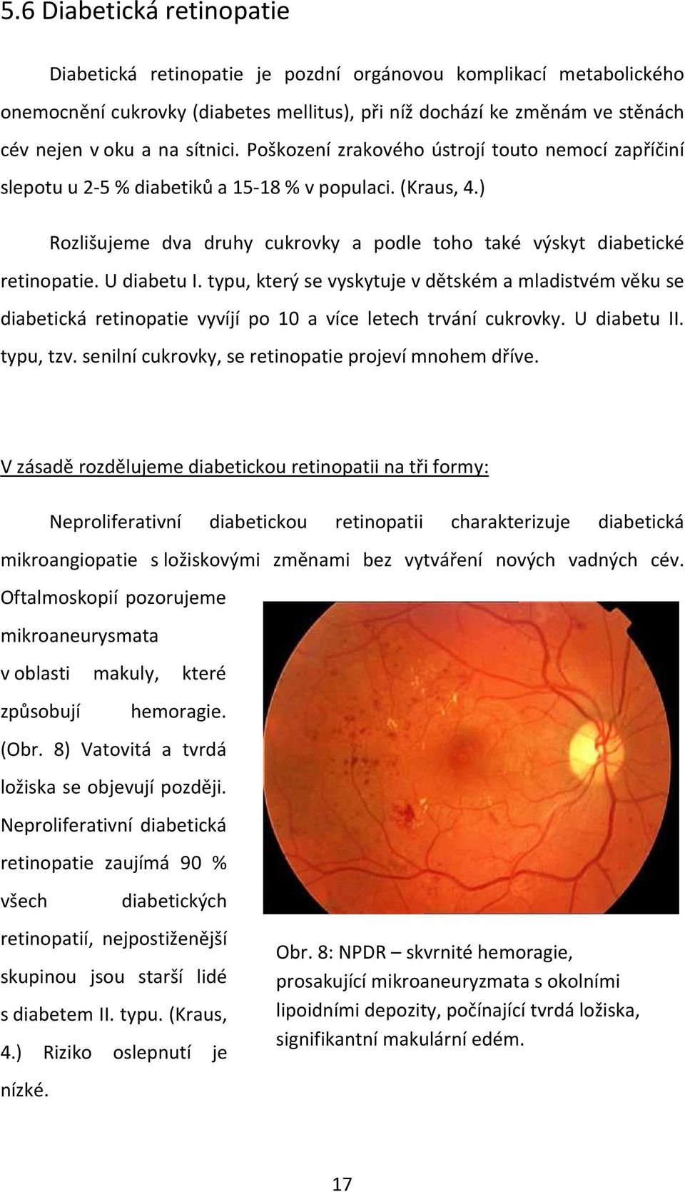 U diabetu I. typu, který se vyskytuje v dětském a mladistvém věku se diabetická retinopatie vyvíjí po 10 a více letech trvání cukrovky. U diabetu II. typu, tzv.