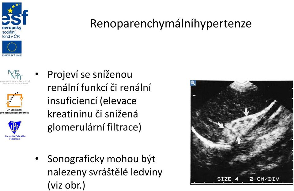 kreatininu či snížená glomerulární filtrace)