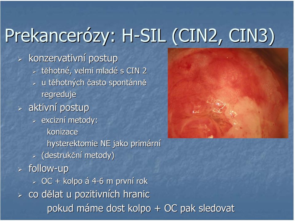 hysterektomie NE jako primárn rní (destrukční metody) follow-up OC + kolpo á 4-66 m