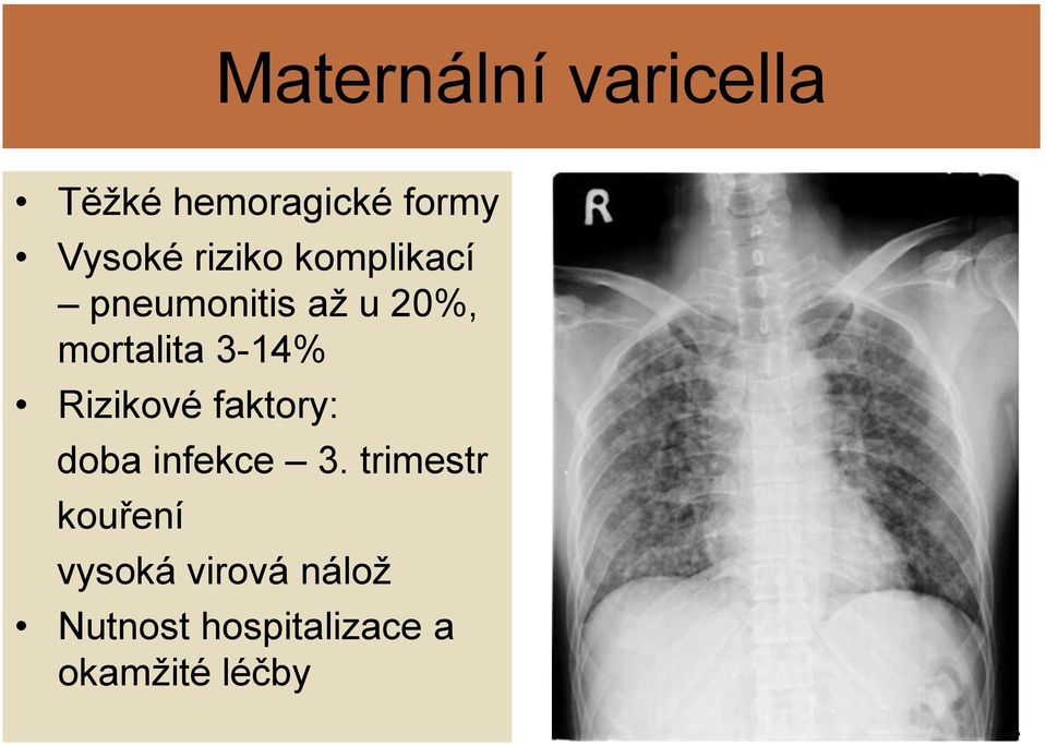 3-14% Rizikové faktory: doba infekce 3.