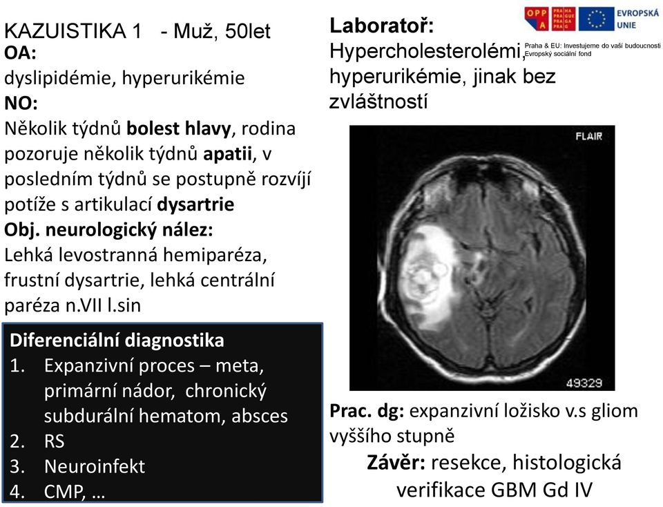 sin Diferenciální diagnostika 1. Expanzivní proces meta, primární nádor, chronický subdurální hematom, absces 2. RS 3. Neuroinfekt 4.