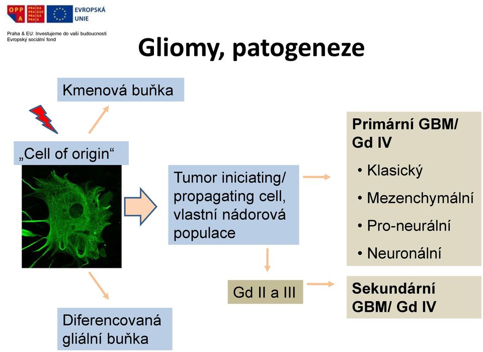 cell, vlastní nádorová populace Gd II a III Primární GBM/