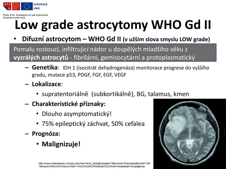 VEGF Lokalizace: supratentoriálně (subkortikálně), BG, talamus, kmen Charakteristické příznaky: Dlouho asymptomatický!