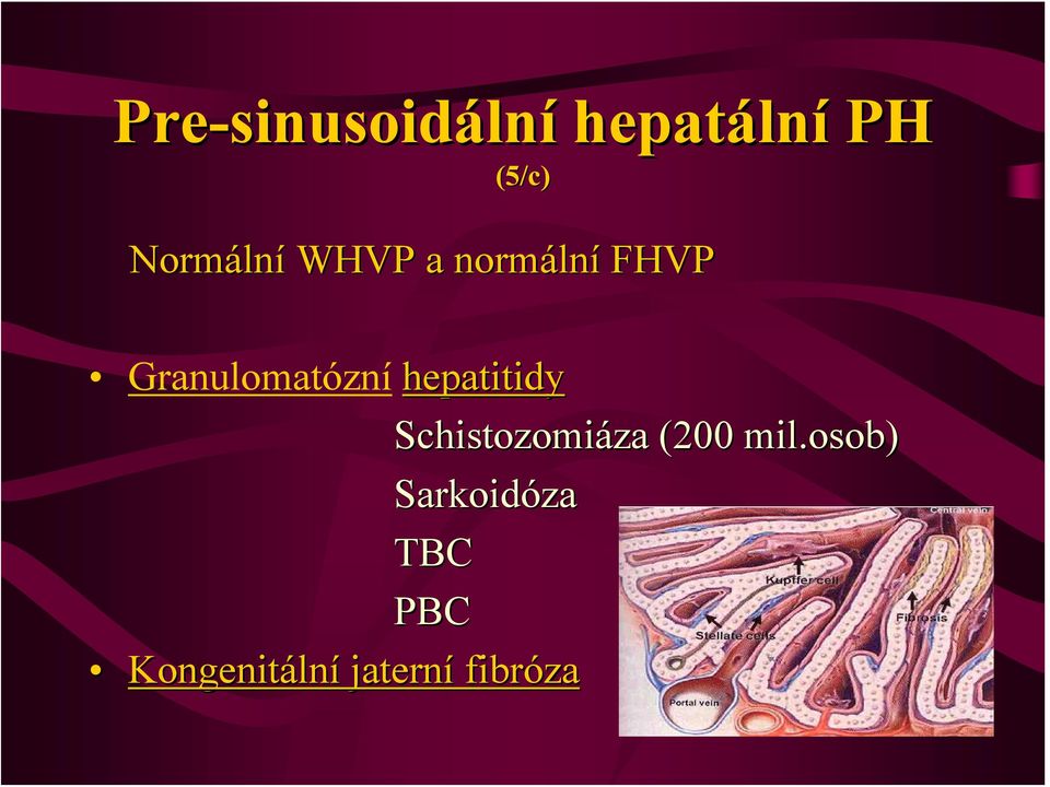 Granulomatózní hepatitidy Schistozomiáza za (200