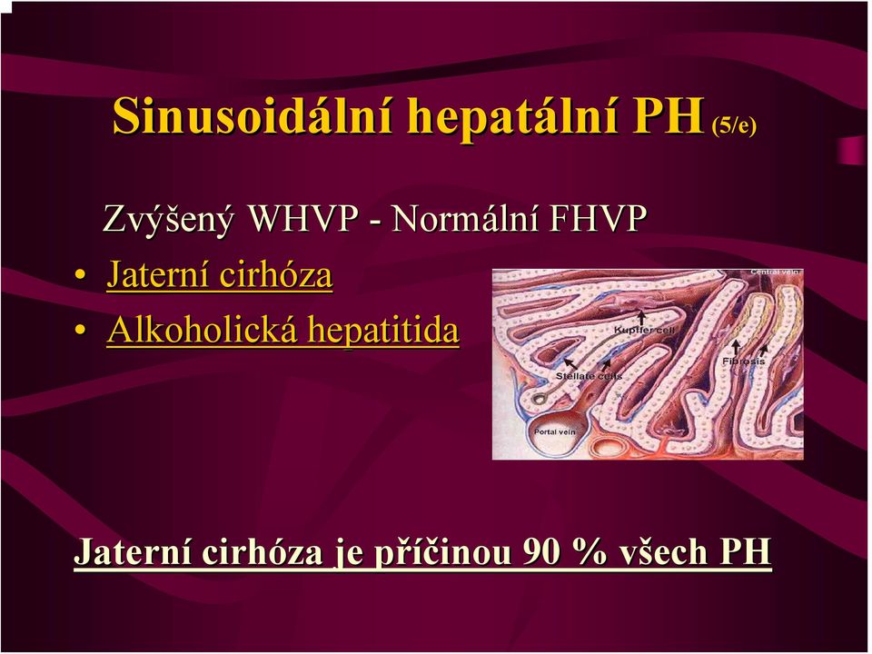 Jaterní cirhóza Alkoholická hepatitida