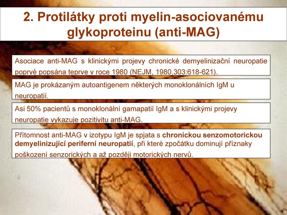 Asi 50% pacientů s monoklonální gamapatií IgM a s klinickými projevy neuropatie vykazuje pozitivitu anti-mag.