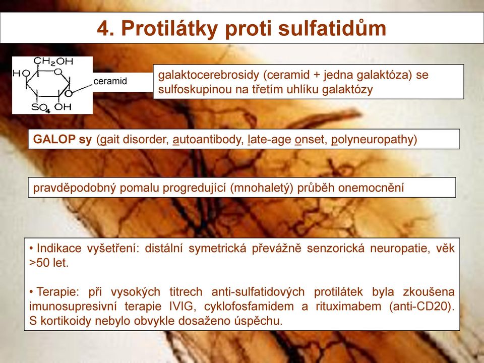 Indikace vyšetření: distální symetrická převážně senzorická neuropatie, věk >50 let.