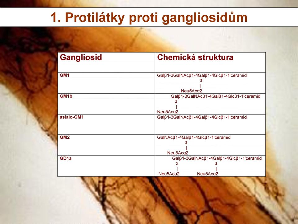 Galβ1-3GalNAcβ1-4Galβ1-4Glcβ1-1'ceramid 3 Neu5Acα2 asialo-gm1