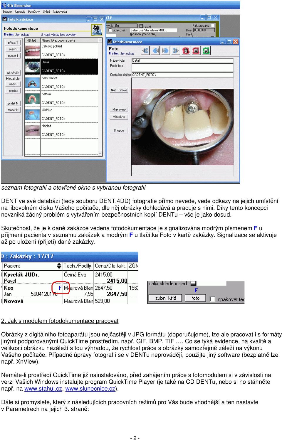 Díky tento koncepci nevzniká žádný problém s vytvářením bezpečnostních kopií DENTu vše je jako dosud.