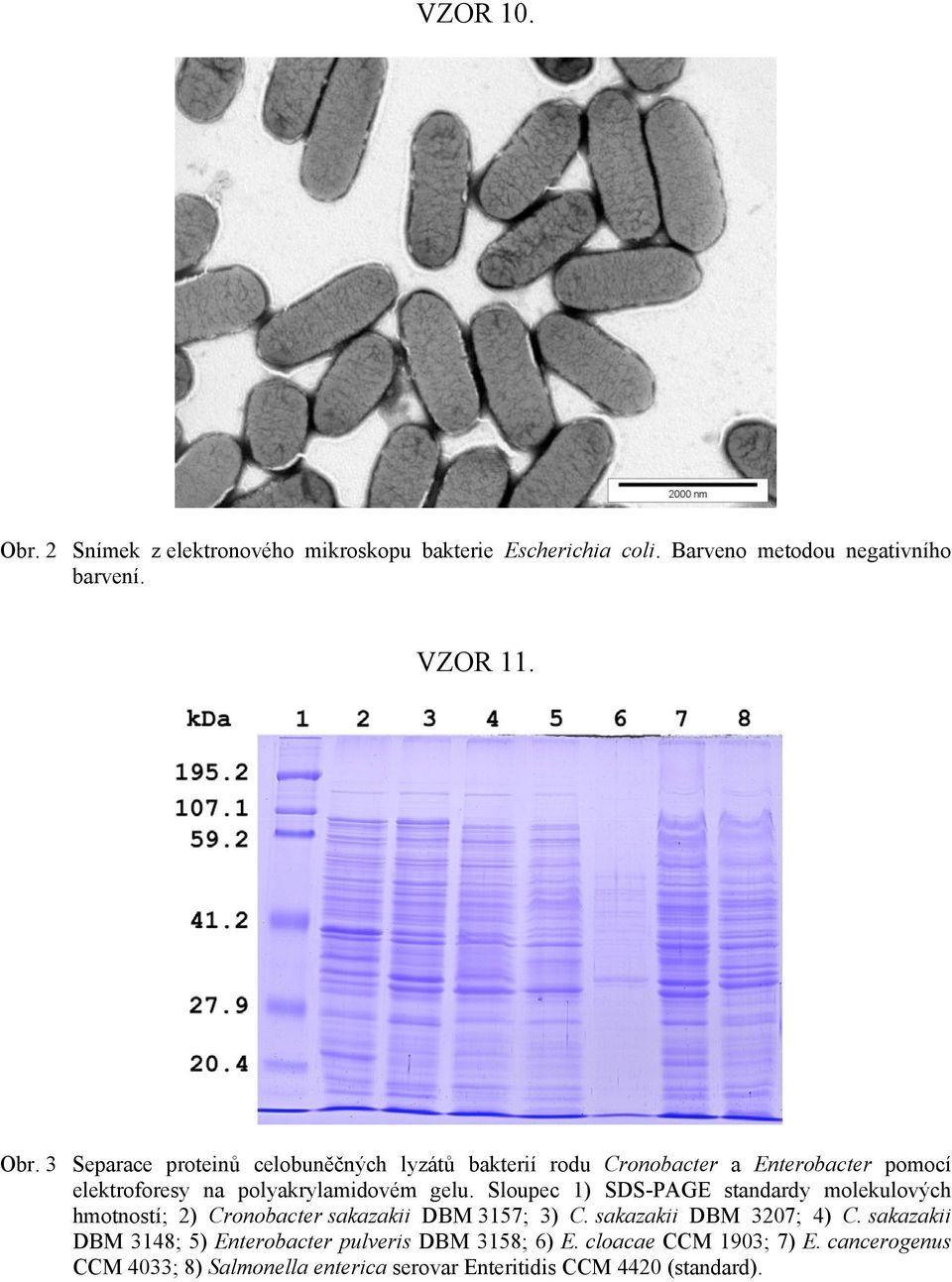 3 Separace proteinů celobuněčných lyzátů bakterií rodu Cronobacter a Enterobacter pomocí elektroforesy na polyakrylamidovém gelu.