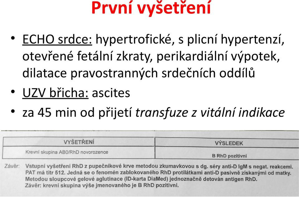 výpotek, dilatace pravostranných srdečních oddílů UZV