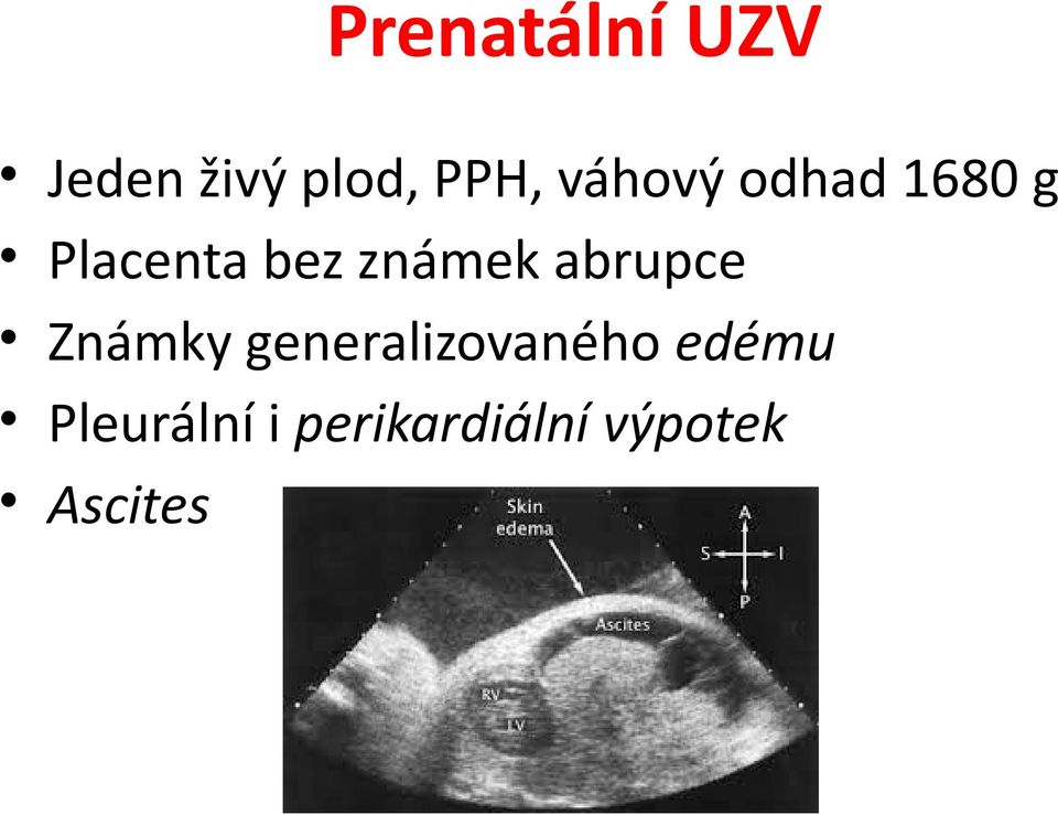 známek abrupce Známky generalizovaného