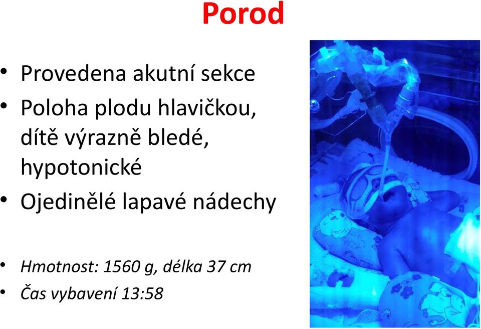 hypotonické Ojedinělé lapavé nádechy