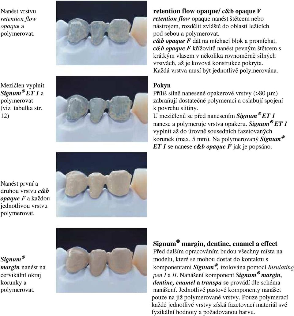 c&b opaque F křížovitě nanést pevným štětcem s krátkým vlasem v několika rovnoměrně silných vrstvách, až je kovová konstrukce pokryta. Každá vrstva musí být jednotlivě polymerována.