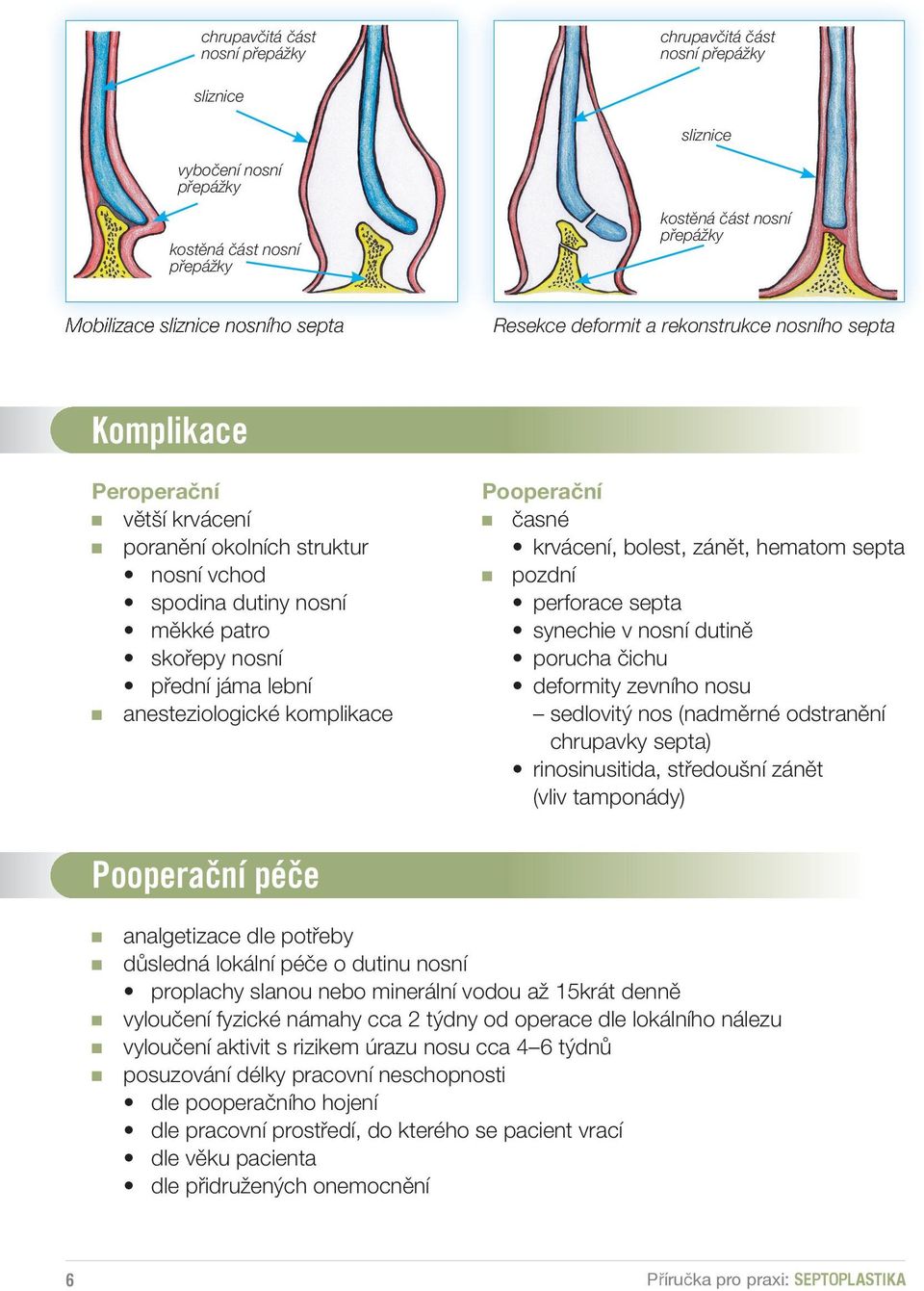 anesteziologické komplikace Pooperační časné krvácení, bolest, zánět, hematom septa pozdní perforace septa synechie v nosní dutině porucha čichu deformity zevního nosu sedlovitý nos (nadměrné