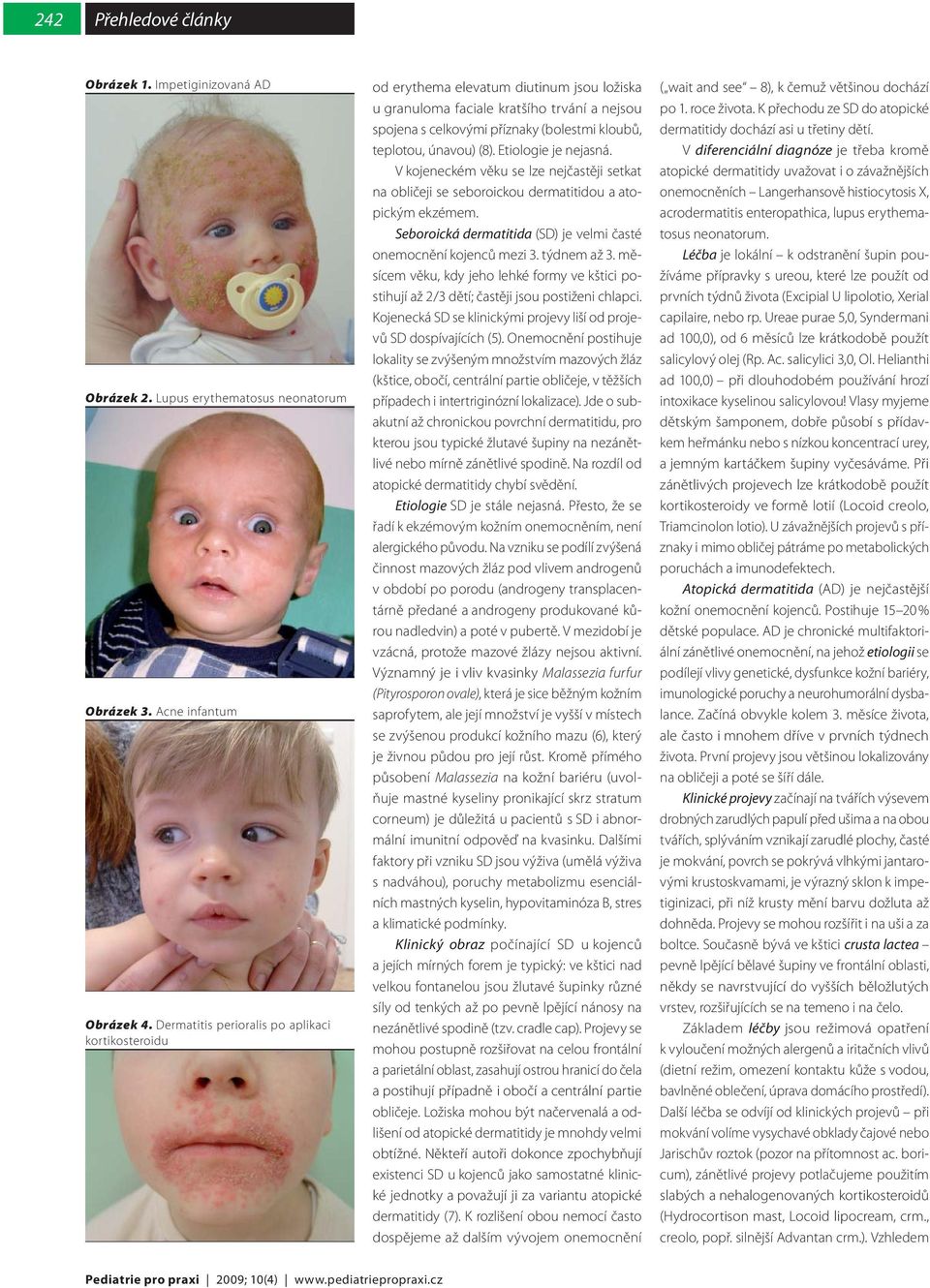únavou) (8). Etiologie je nejasná. V kojeneckém věku se lze nejčastěji setkat na obličeji se seboroickou dermatitidou a atopickým ekzémem.