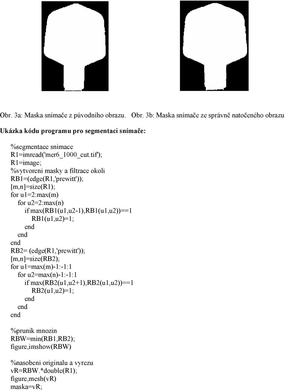 tif'); R1=image; %vytvoreni masky a filtrace okoli RB1=(edge(R1,'prewitt')); [m,n]=size(r1); for u1=2:max(m) for u2=2:max(n) if