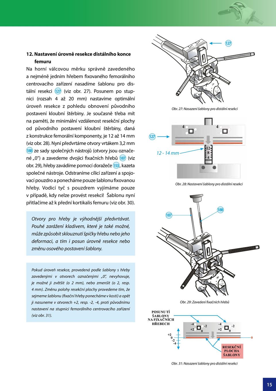 Je současně třeba mít na paměti, že minimální vzdálenost resekční plochy od původního postavení kloubní štěrbiny, daná z konstrukce femorální komponenty, je 2 až mm (viz obr. 28).