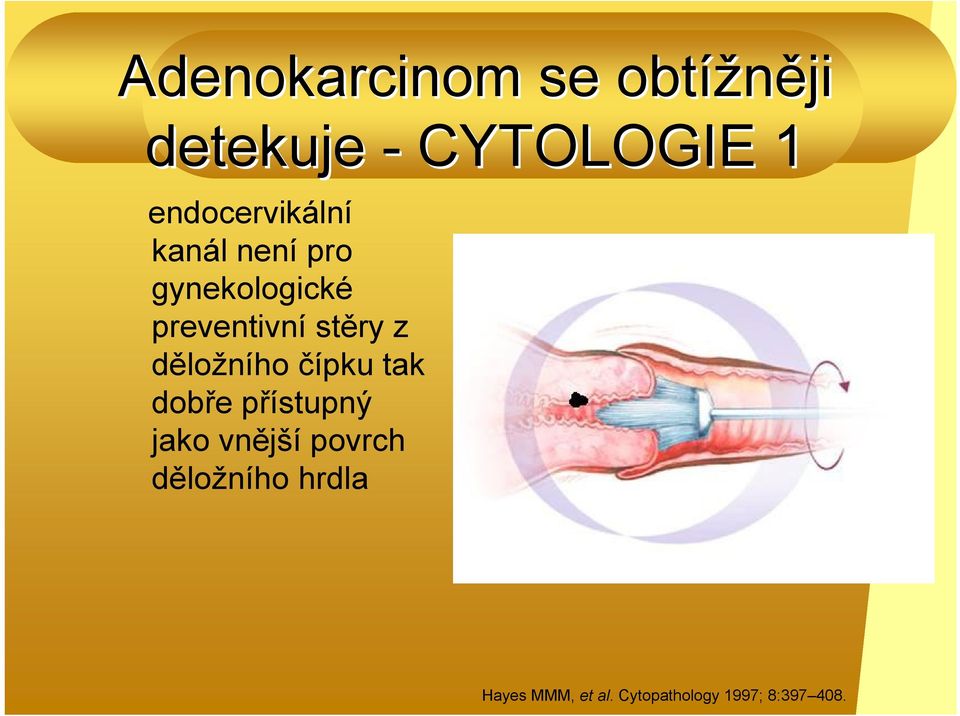 stěry z děložního čípku tak dobře přístupný jako vnější