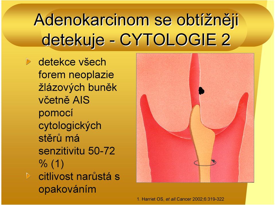 cytologických stěrů má senzitivitu 50-72 % (1) citlivost