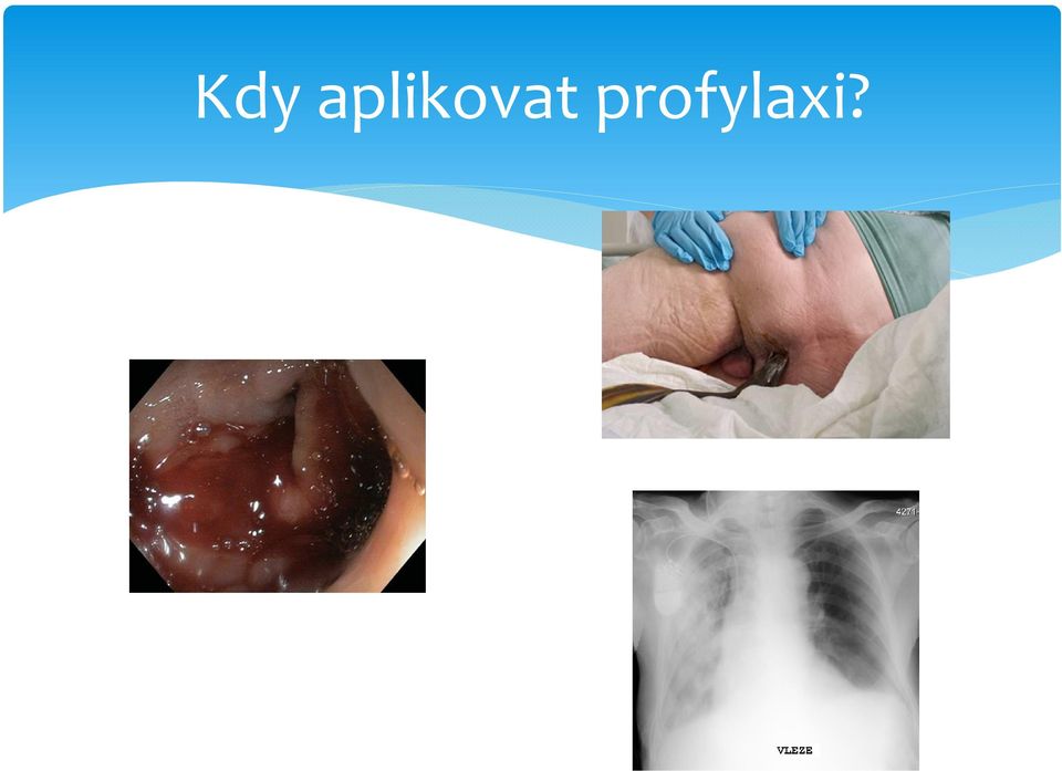 profylaxi?