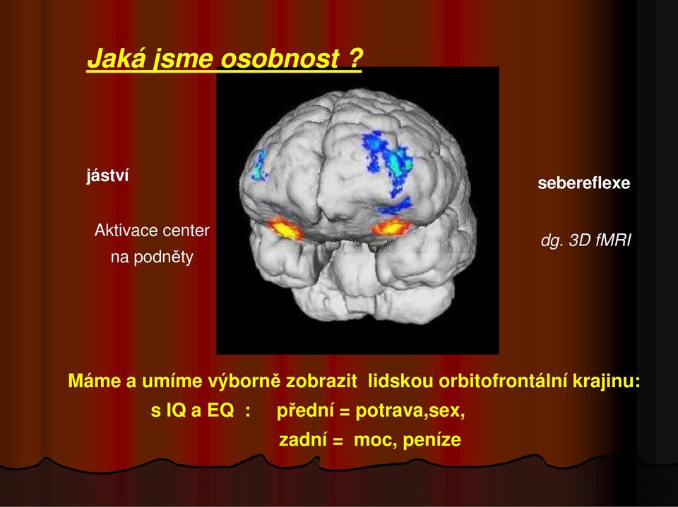 3D fmri Máme a umíme výborně zobrazit lidskou