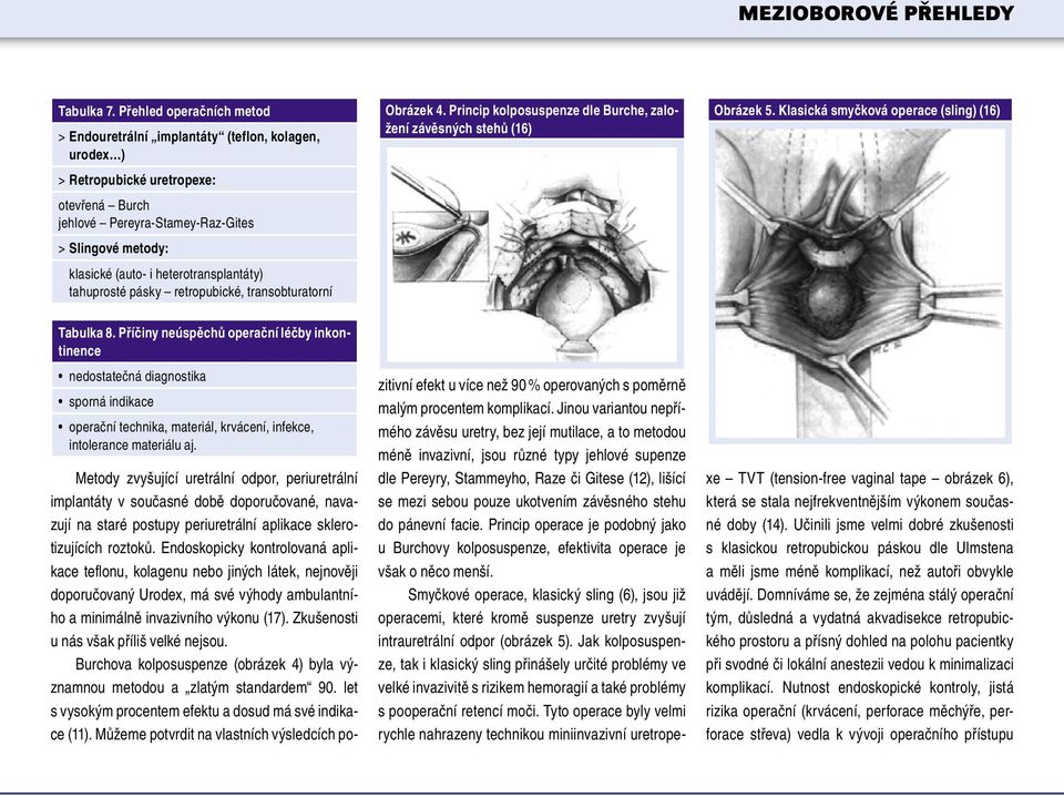 heterotransplantáty) tahuprosté pásky retropubické, transobturatorní Obrázek 4. Princip kolposuspenze dle Burche, založení závěsných stehů (16) Obrázek 5.