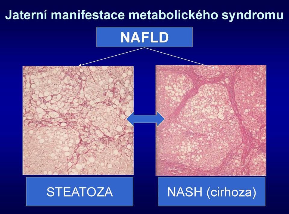 metabolického