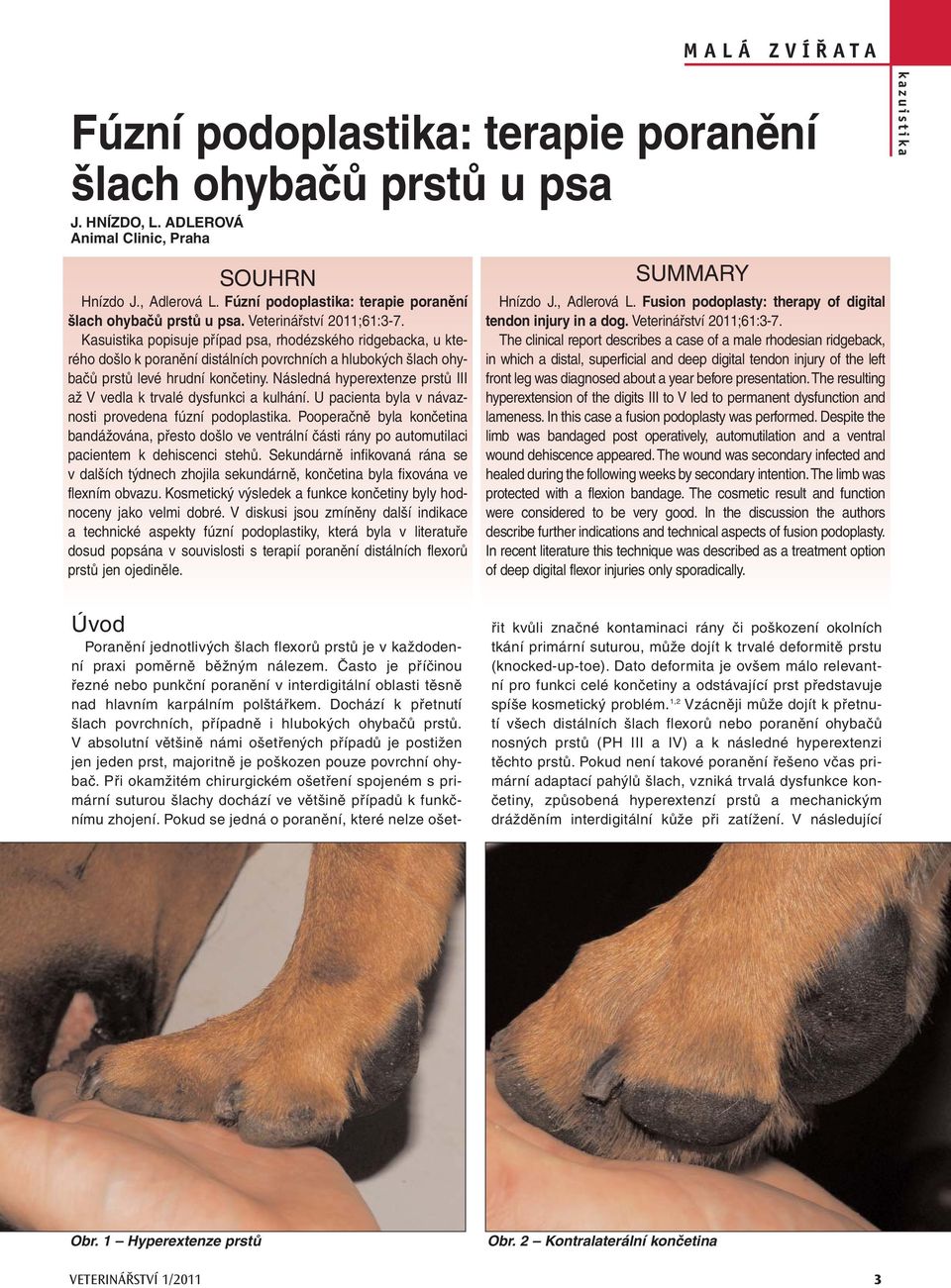 Následná hyperextenze prstů III až V vedla k trvalé dysfunkci a kulhání. U pacienta byla v návaznosti provedena fúzní podoplastika.