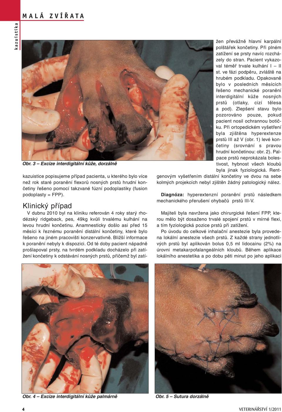 Anamnesticky došlo asi před 15 měsíci k řeznému poranění distální končetiny, které bylo řešeno na jiném pracovišti konzervativně. Bližší informace k poranění nebyly k dispozici.