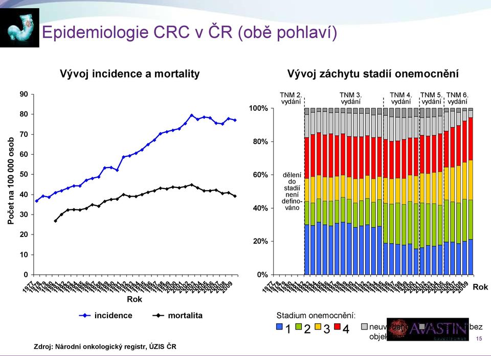 vydání 70 80% 60 50 40 30 60% 40% dělení do stadií není definováno 20 10 0 1977 1978 1979 1980 1981 1982 1983 1984 1985 1986 1987 1988 1989 1990 1991 1992 1993 incidence 1994 1995 Rok