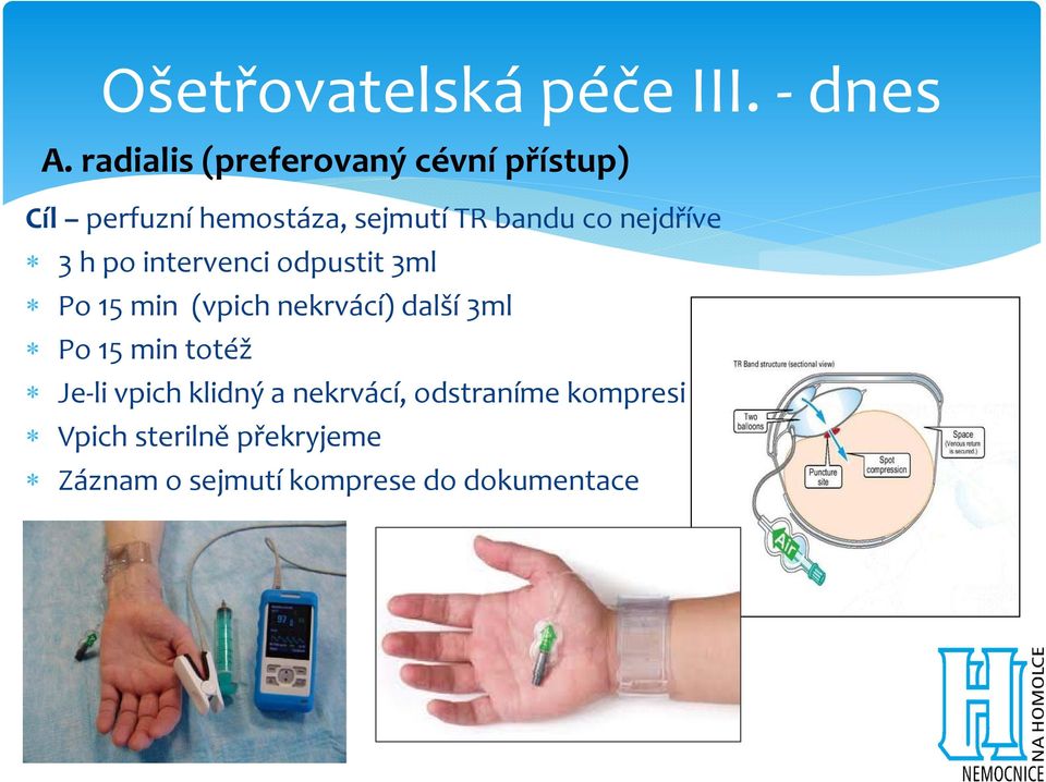 nejdříve 3 h po intervenci odpustit 3ml Po 15 min (vpich nekrvácí) další 3ml Po