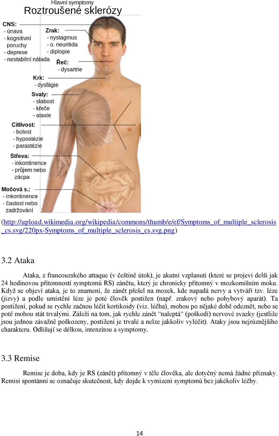 Kdyţ se objeví ataka, je to znamení, ţe zánět přešel na mozek, kde napadá nervy a vytváří tzv. léze (jizvy) a podle umístění léze je poté člověk postiţen (např. zrakový nebo pohybový aparát).