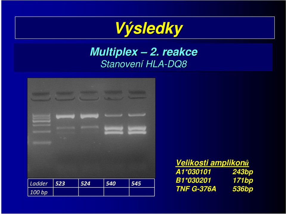 524 540 545 100 bp Velikosti