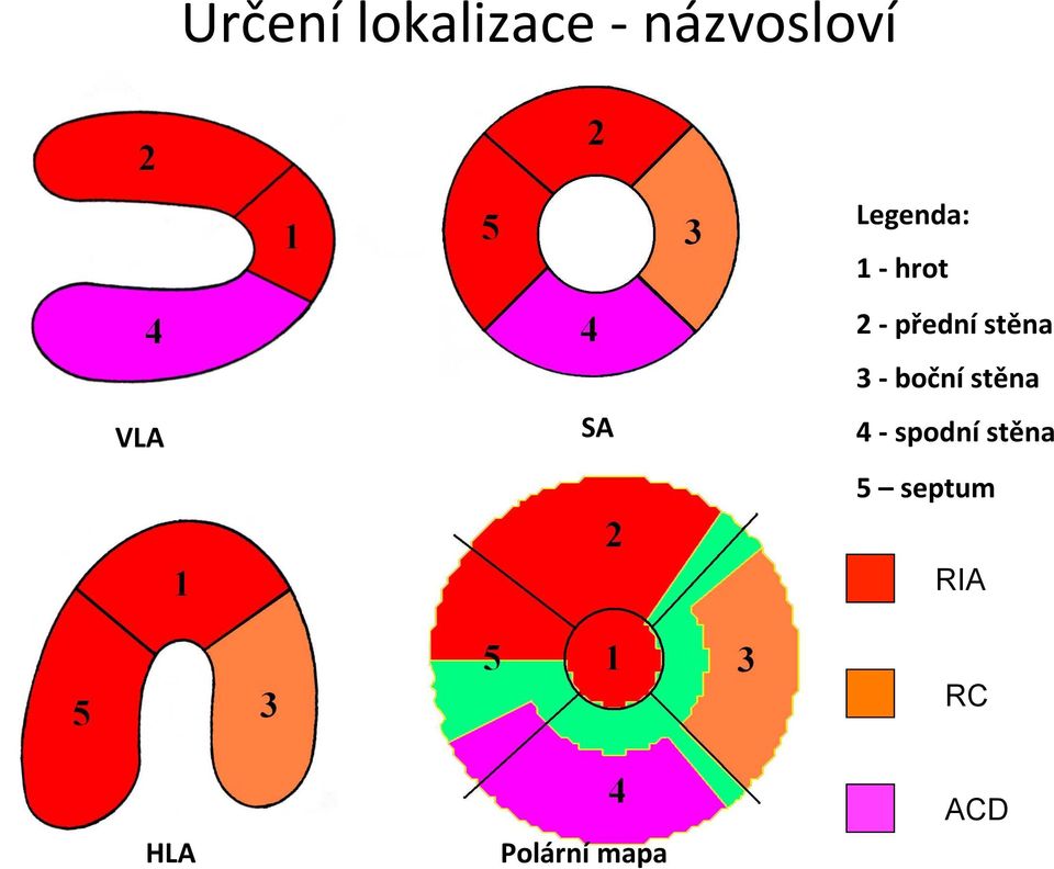 stěna 3 - boční stěna 4 - spodní