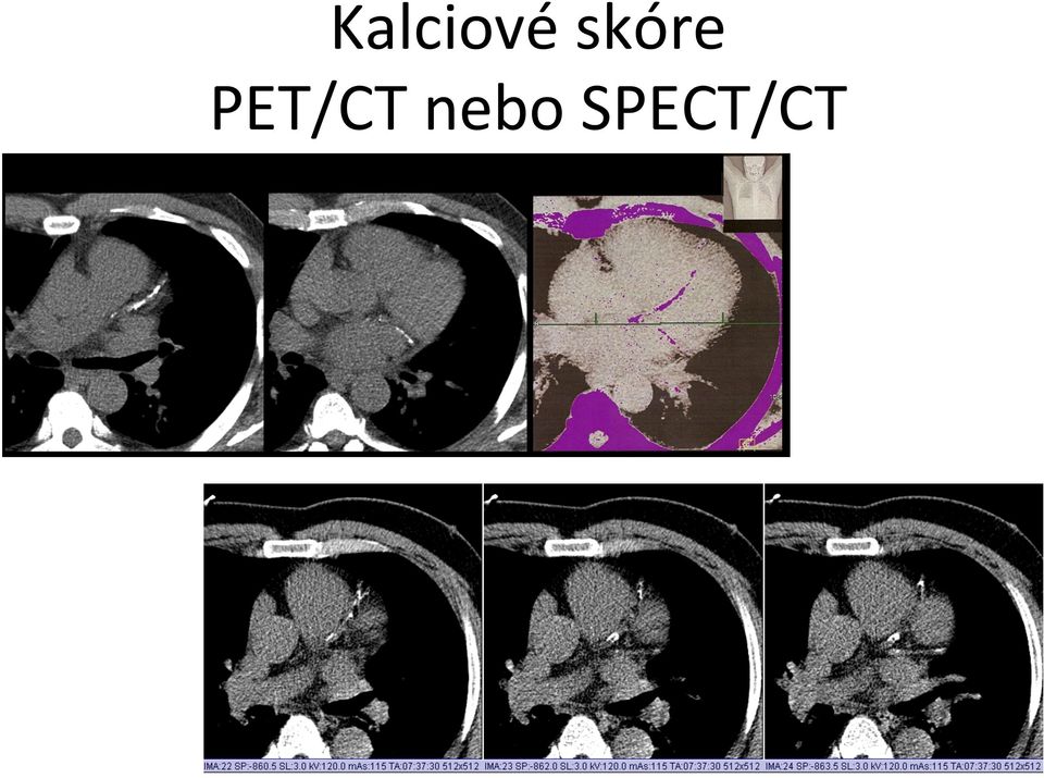 PET/CT