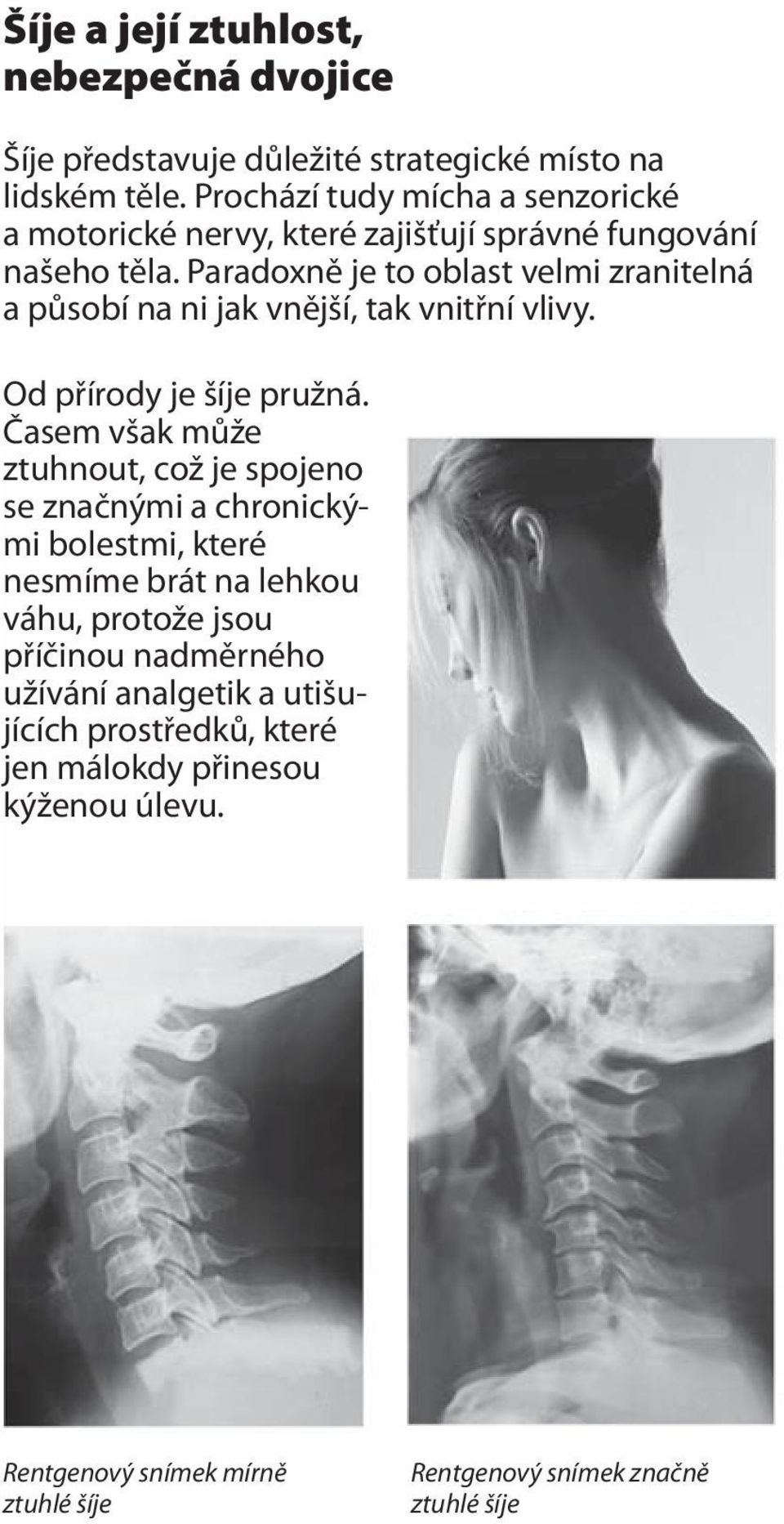 Paradoxně je to oblast velmi zranitelná a působí na ni jak vnější, tak vnitřní vlivy. Od přírody je šíje pružná.