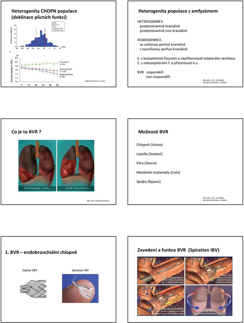 ntilace E. s nekompletními f. a přítomností k.v. AJRCCM Nishimura 2011 BVR respondeři non-responděři ERS 2011 ECE ISTANBUL ERS 2011 VALIPOUR VIENNA Co je to BVR?