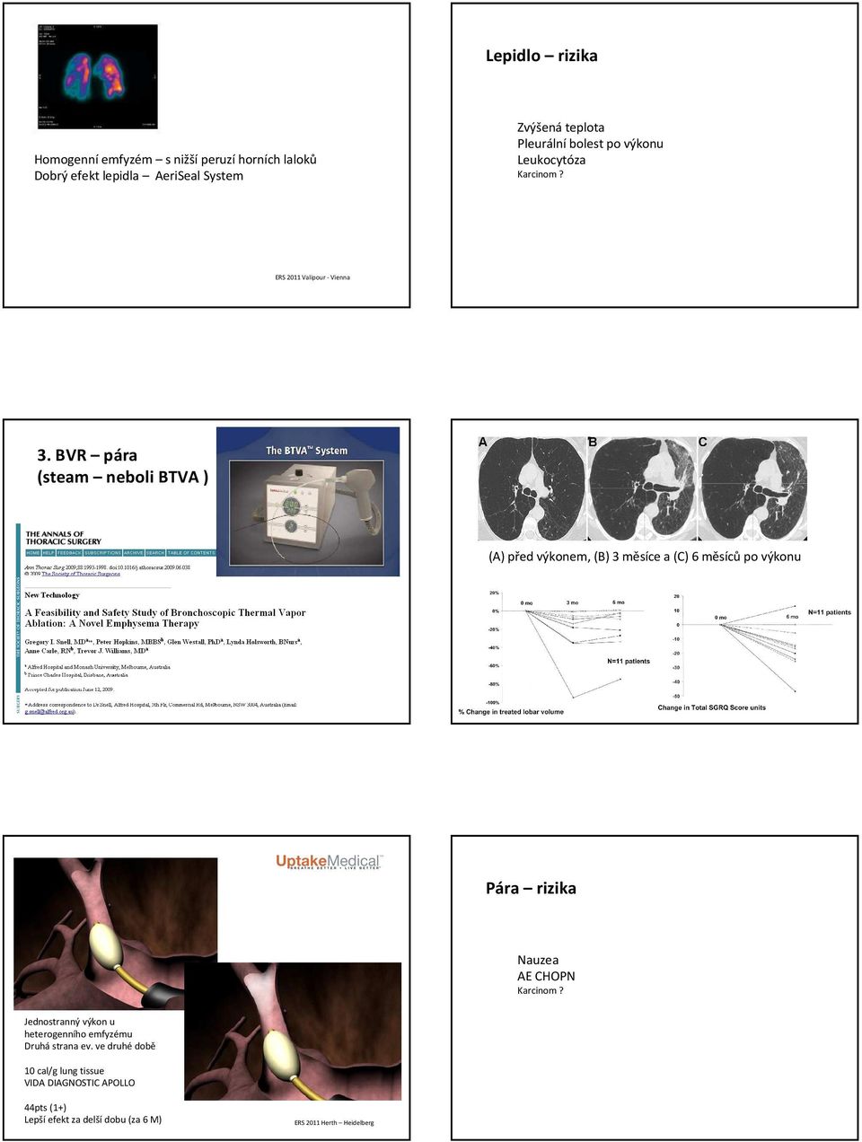 BVR pára (steam neboli BTVA ) (A) před výkonem, (B) 3 měsíce a(c) 6 měsícůpo výkonu Pára rizika Nauzea AE CHOPN Karcinom?