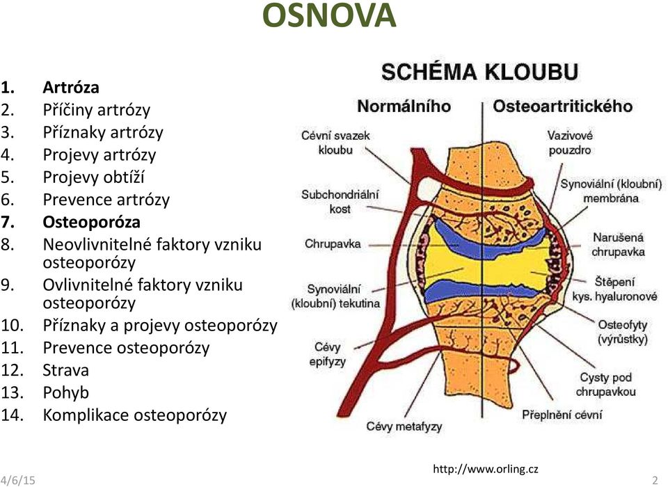 Neovlivnitelné faktory vzniku osteoporózy 9. Ovlivnitelné faktory vzniku osteoporózy 10.