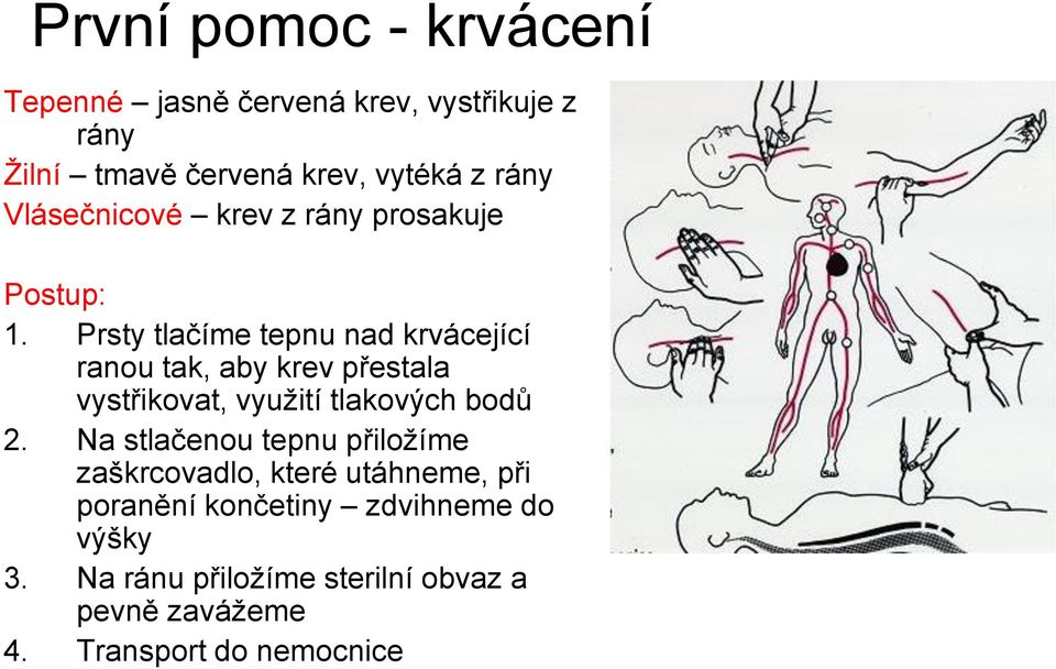 Prsty tlačíme tepnu nad krvácející ranou tak, aby krev přestala vystřikovat, využití tlakových bodů 2.