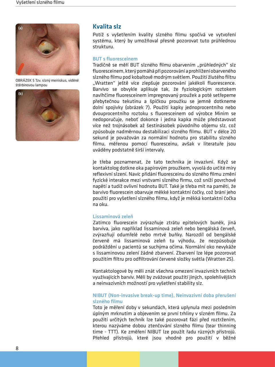 BUT s fluoresceinem Tradičně se měří BUT slzného filmu obarvením průhledných slz fluoresceinem, který pomáhá při pozorování a prohlížení obarveného slzného filmu pod kobaltově modrým světlem.
