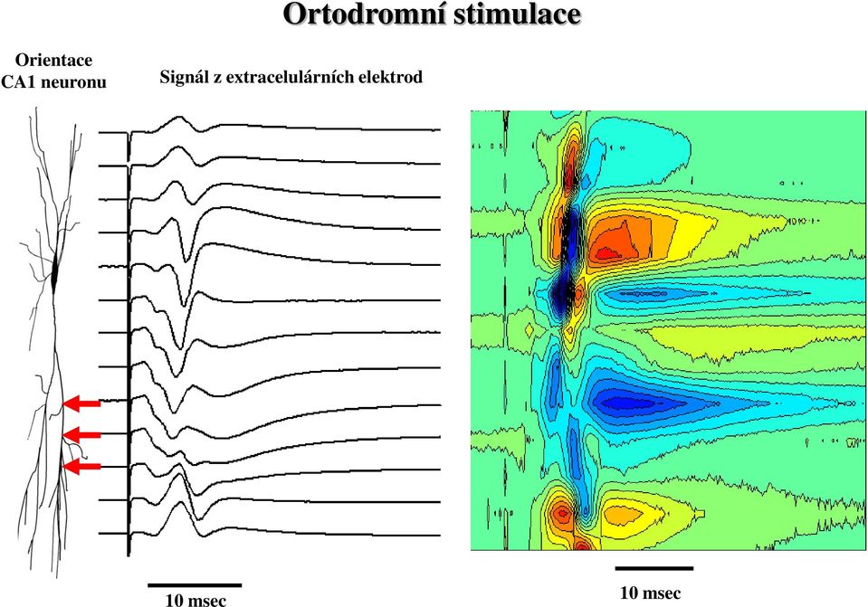 z extracelulárních elektrod