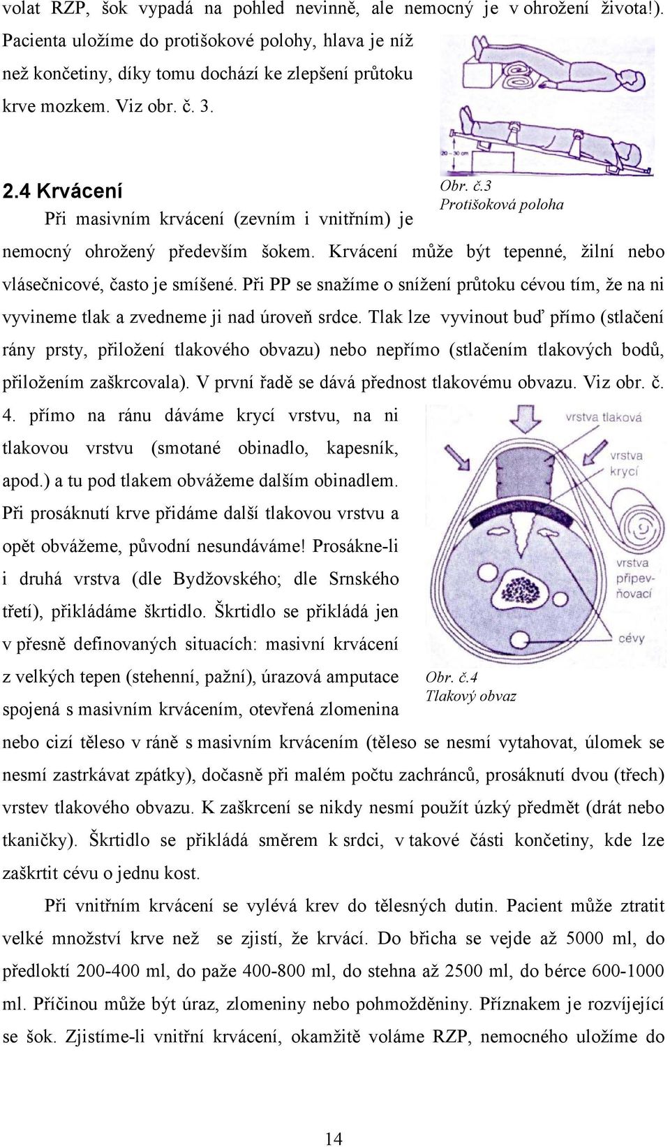 Krvácení může být tepenné, žilní nebo vlásečnicové, často je smíšené. Při PP se snažíme o snížení průtoku cévou tím, že na ni vyvineme tlak a zvedneme ji nad úroveň srdce.