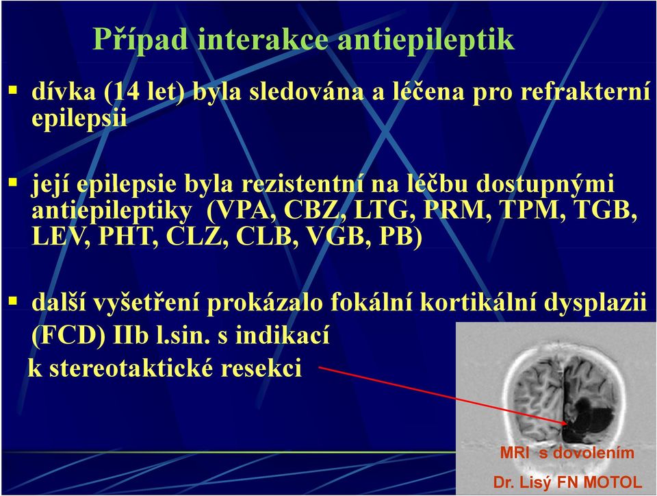 LTG, PRM, TPM, TGB, LEV, PHT, CLZ, CLB, VGB, PB) další vyšetření prokázalo fokální